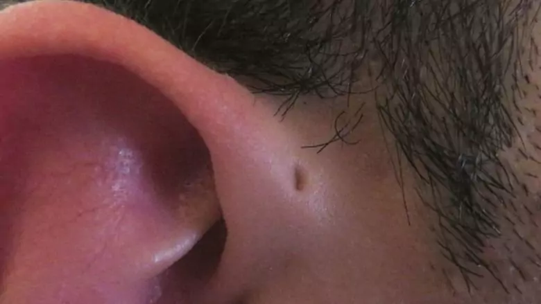 earhole-780x439