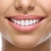 21790157 - closeup of smile with white heatlhy teeth