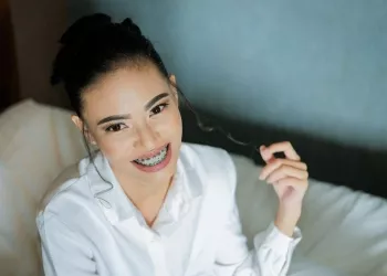 aparat dentar