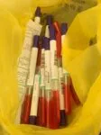 Bacterii intestinale produc compus legat de Alzheimer și declin cognitiv